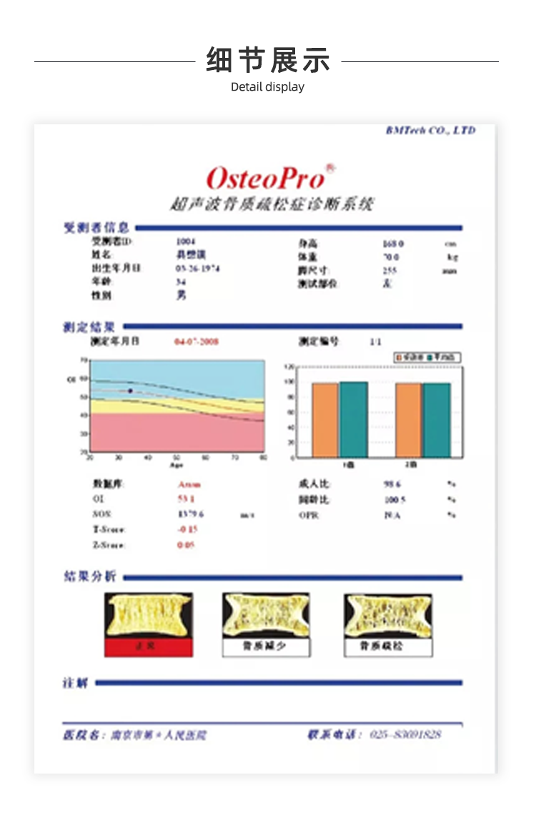 超聲骨密度儀