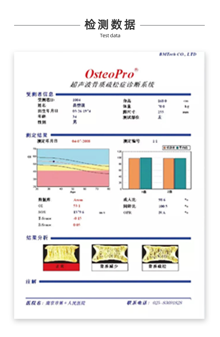 超聲骨密度儀