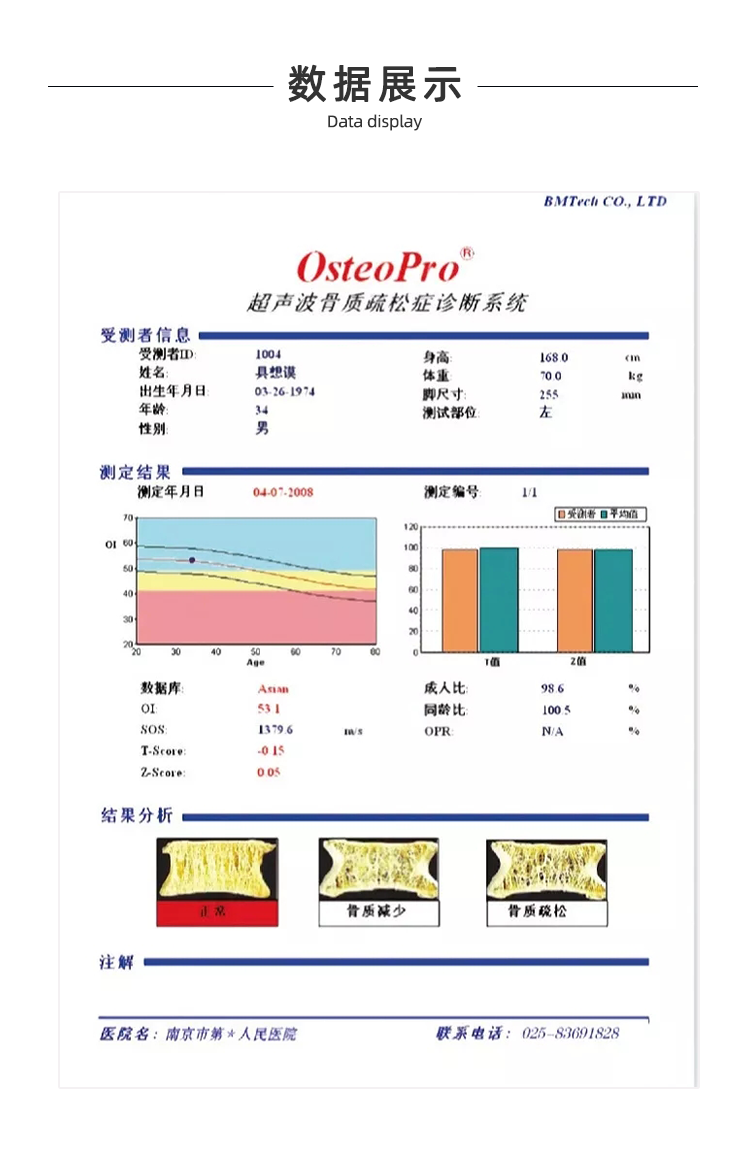 超聲骨密度儀