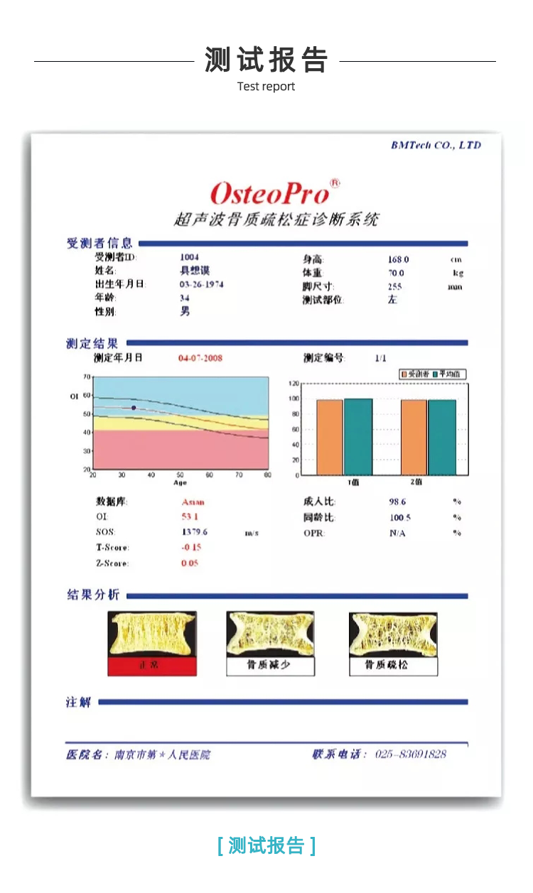 超聲骨密度儀