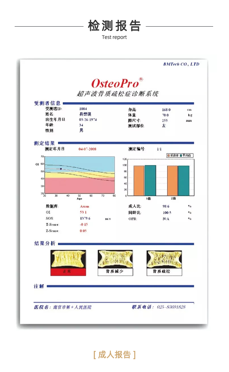 超聲骨密度儀