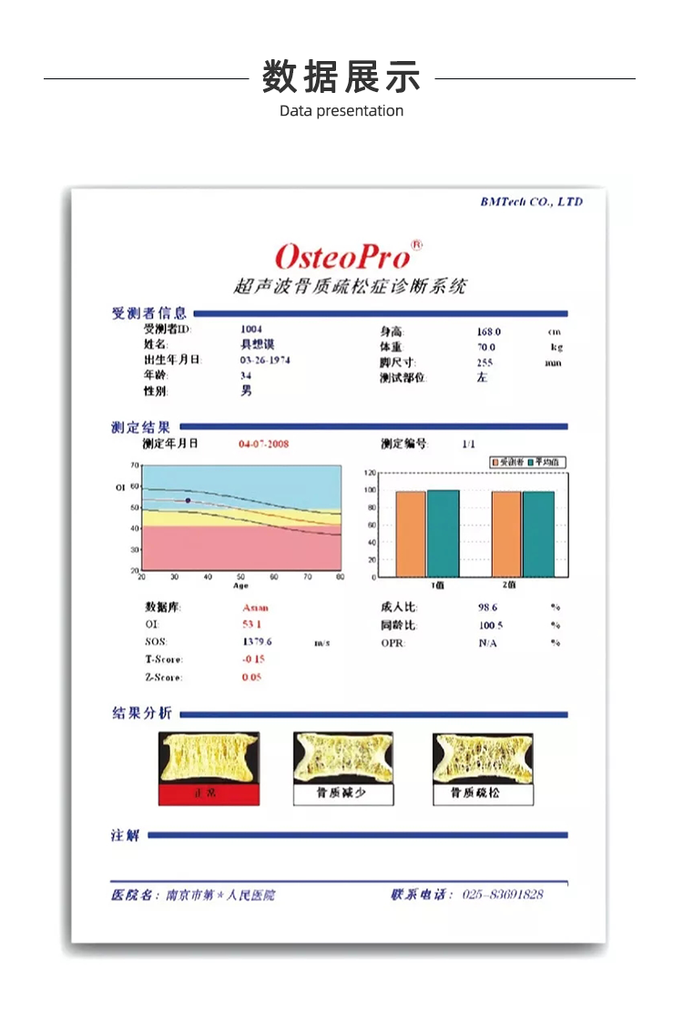 超聲骨密度儀