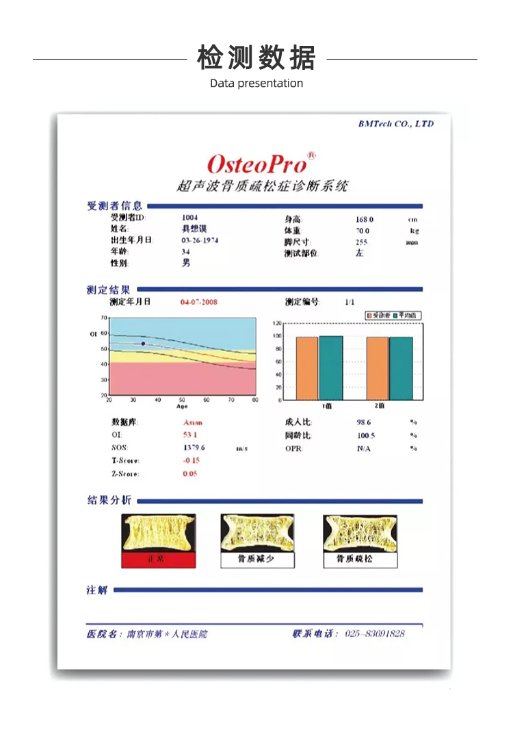 超聲骨密度儀