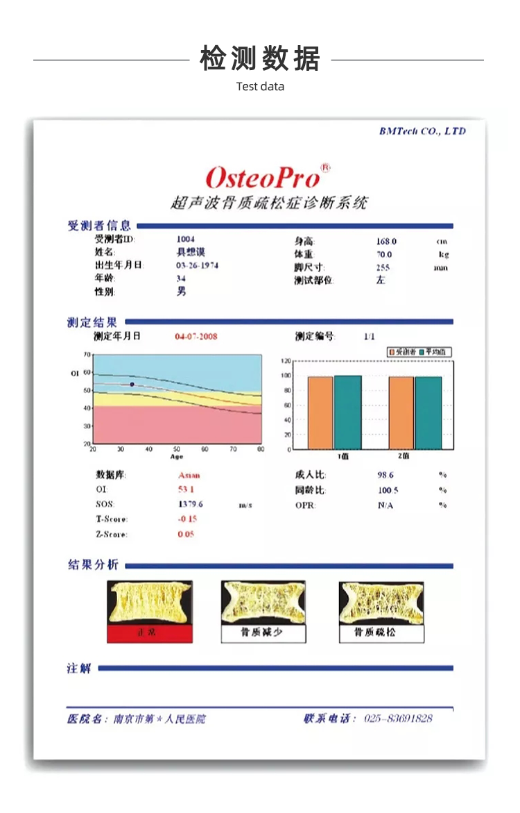 超聲骨密度儀