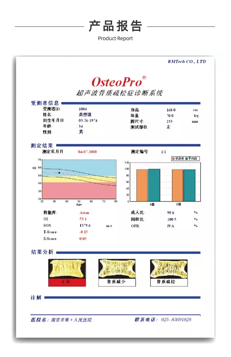 超聲骨密度儀