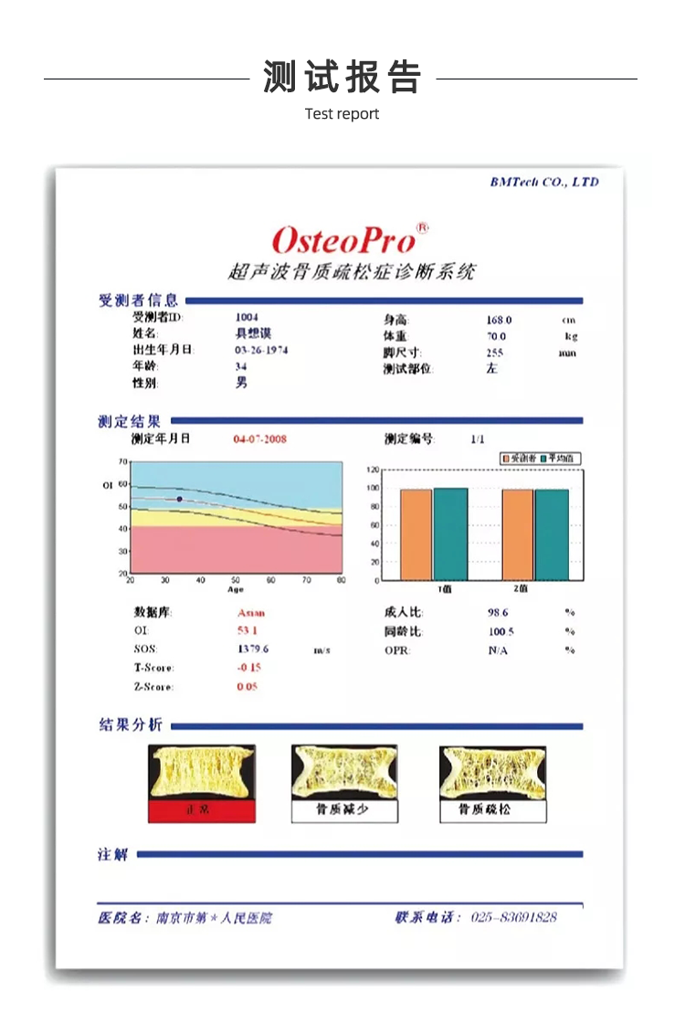 超聲骨密度儀