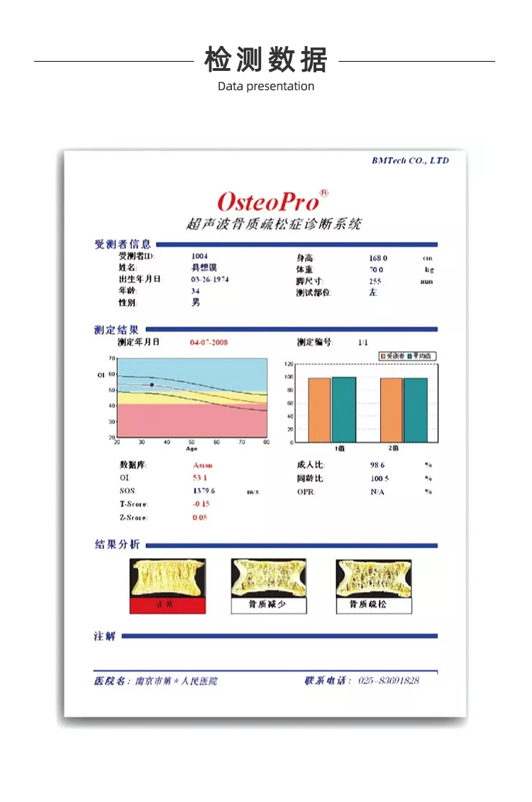 超聲骨密度儀