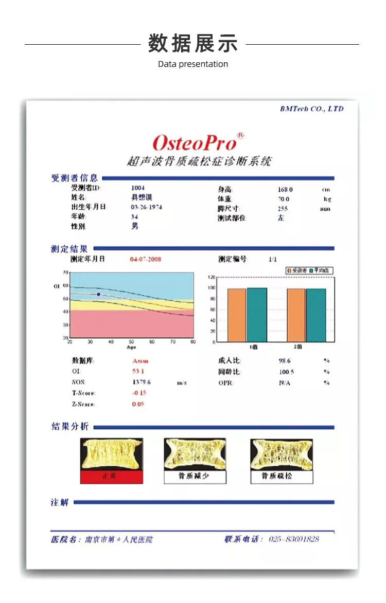 超聲骨密度儀