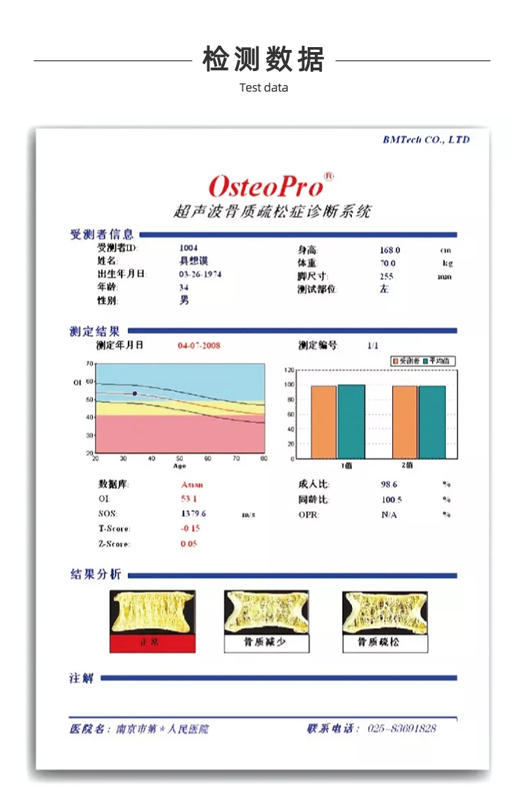 超聲骨密度儀