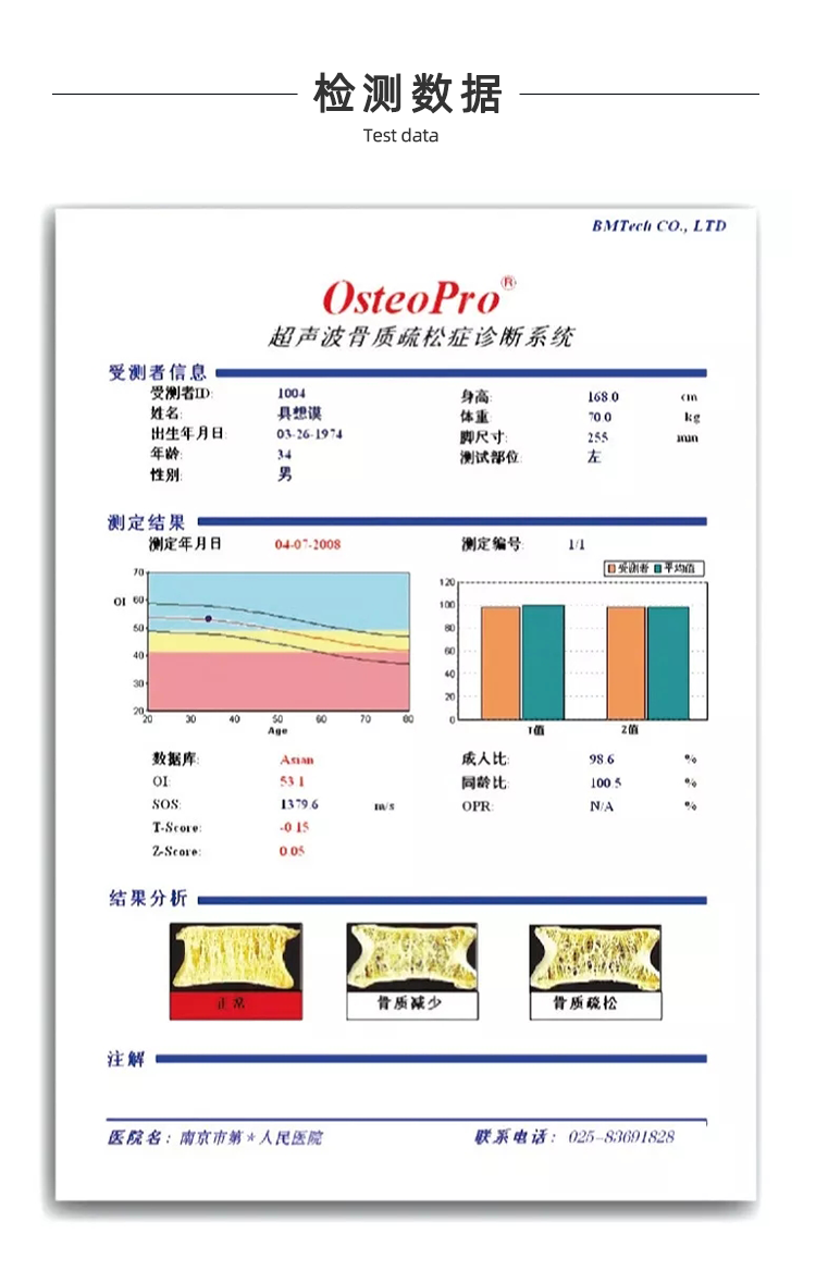 超聲骨密度儀