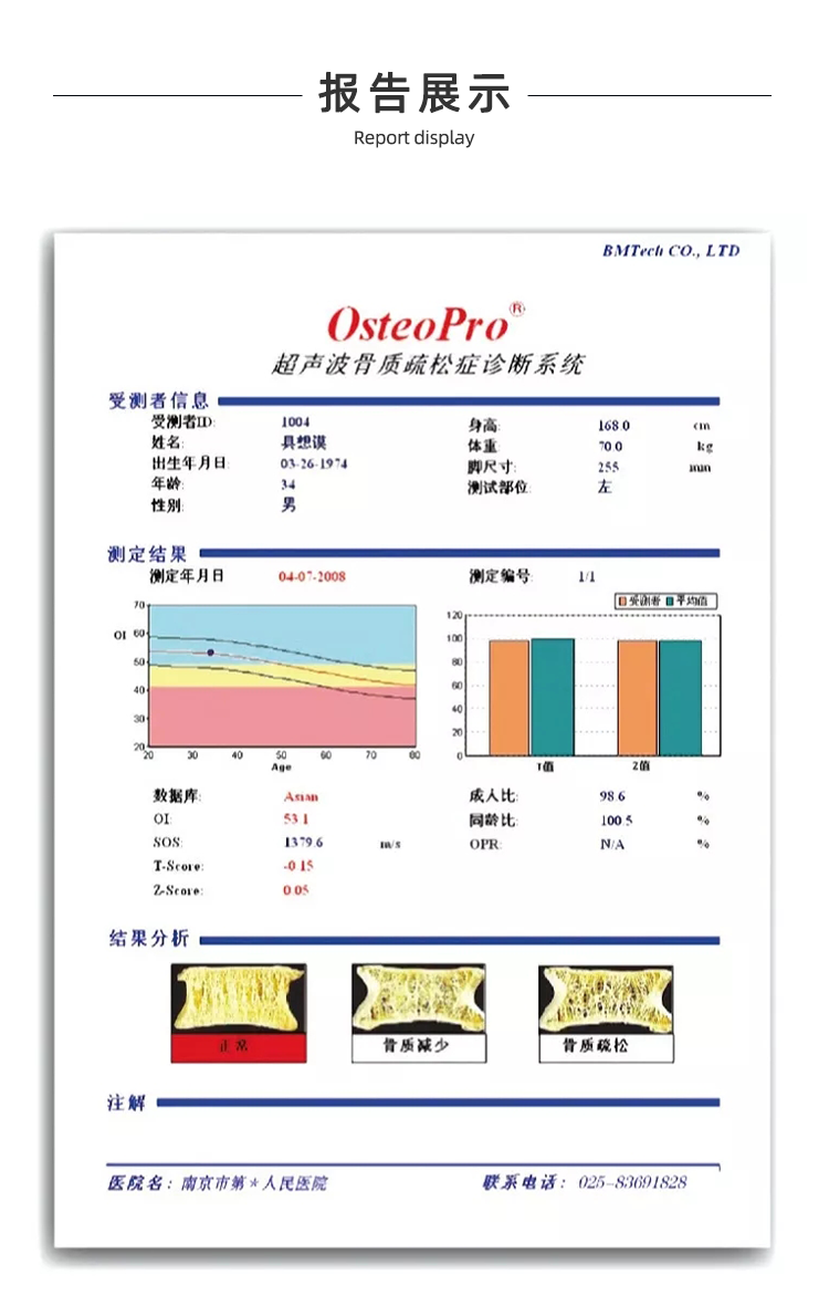 超聲骨密度儀