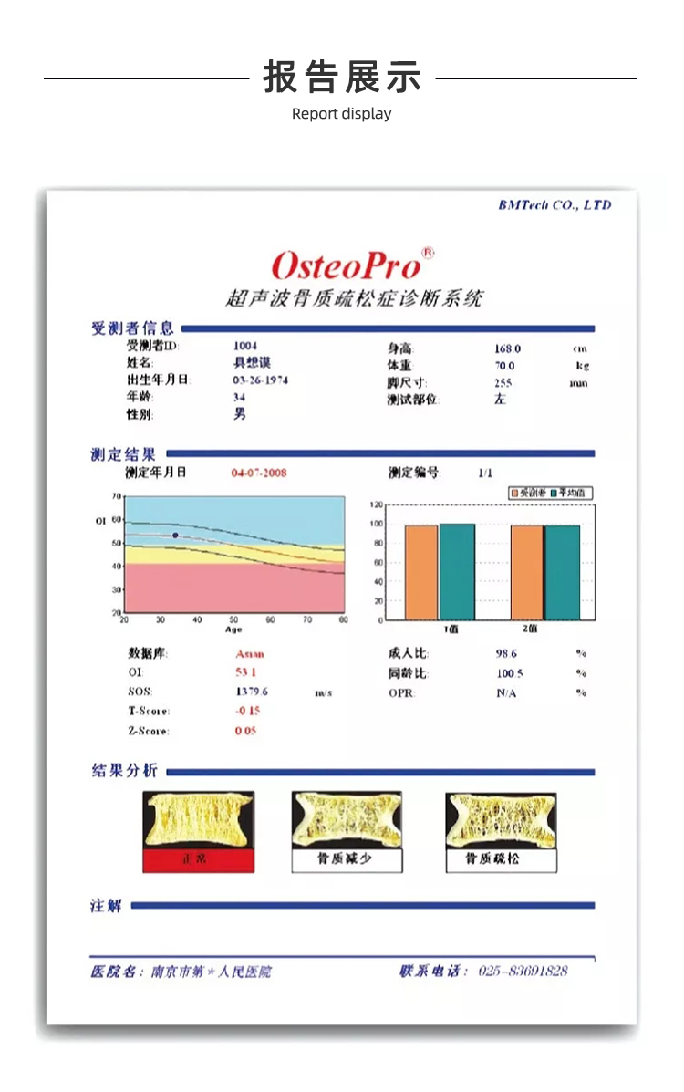 超聲骨密度儀