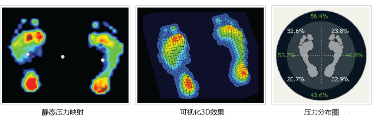 步態(tài)分析